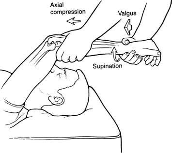 internal rotation flexion axila compression test|Pivot Shift Test .